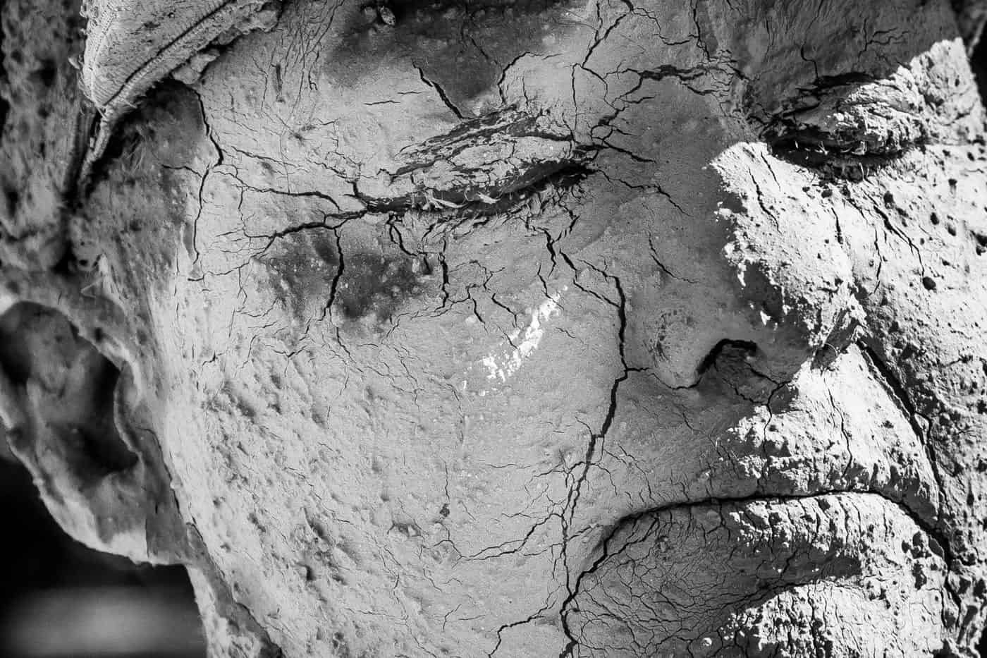 dry-skin-face-man-problem