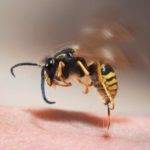 wasp sting