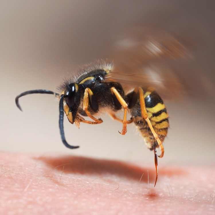 wasp stings